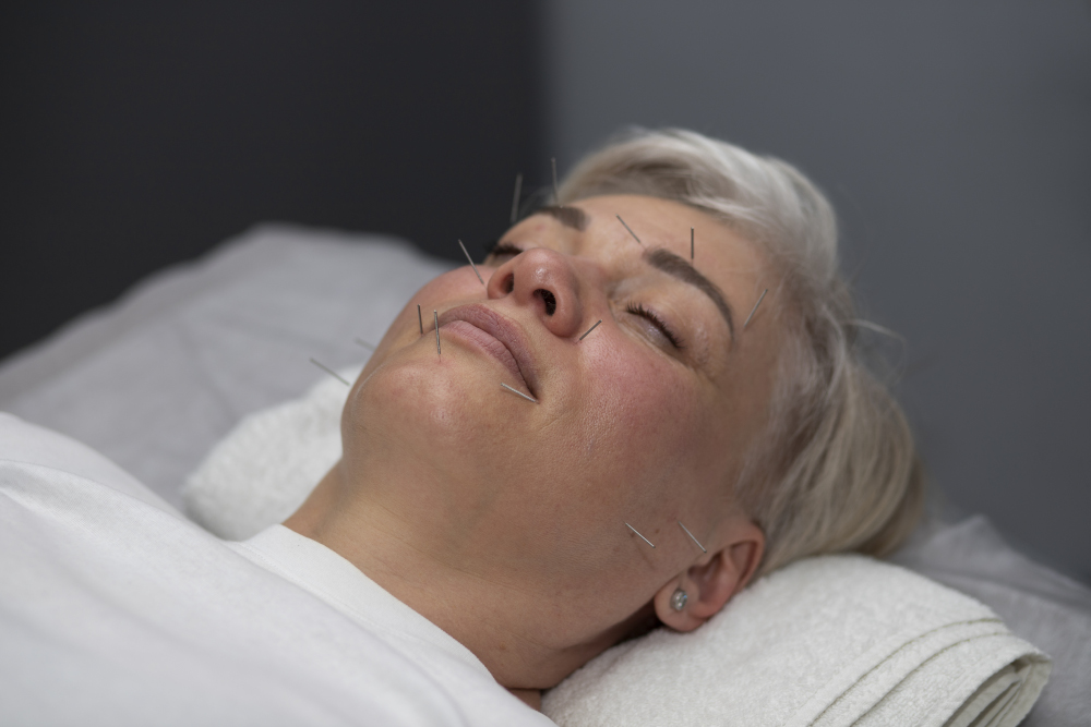 Acupuntura Estética Tenerife Aesthetic Acupuncture Tenerife