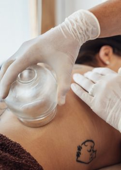 Terapia de Ventosas Tenerife Cupping Therapy Tenerife